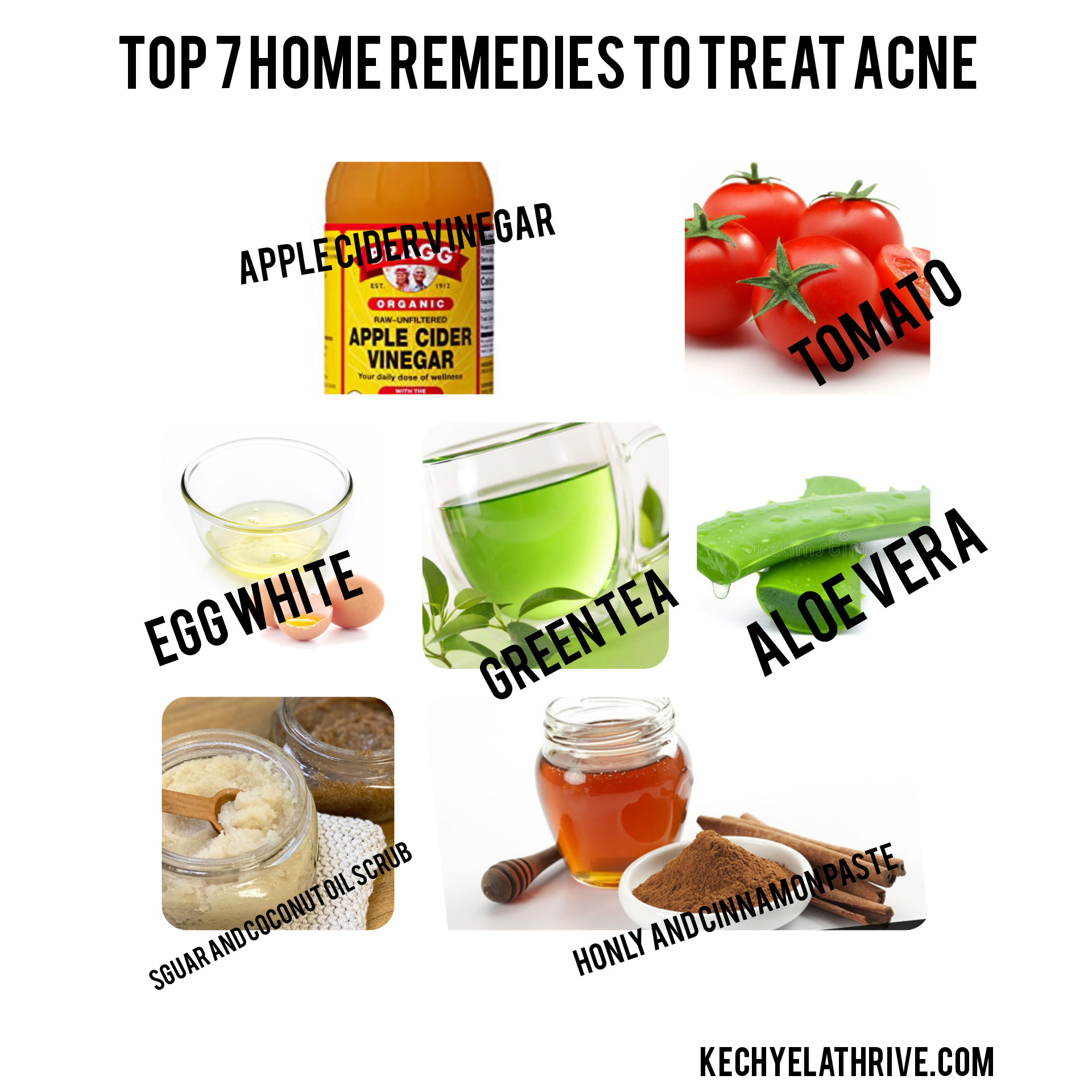 HOW TO TREAT ACNE AT HOME: TOP 7 HOME REMEDIES