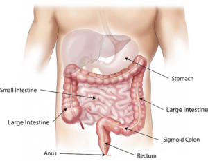 Ulcerative colitis: causes, symptoms, diagnosis, and treatment