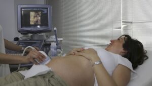 3D Ultrasound Technology