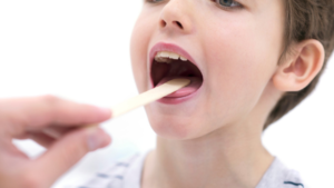 Strep A Symptoms in Children: Recognizing and Managing the Infection