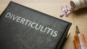 Diverticulitis Treatment and Prevention