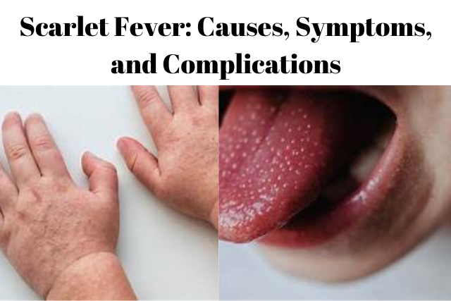 Scarlet Fever: Causes, Symptoms, and Complications