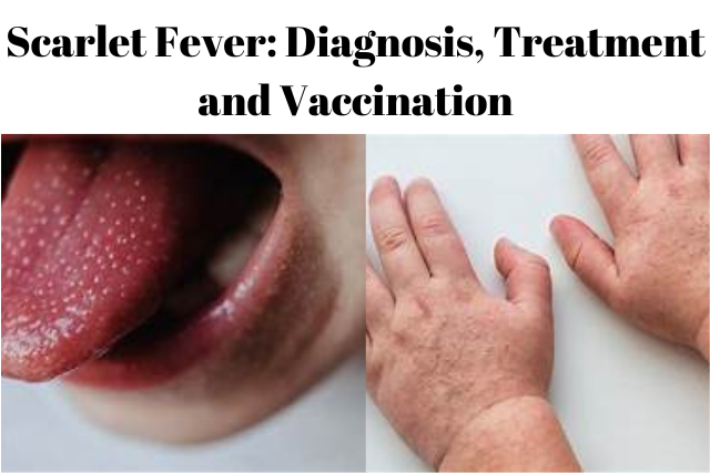 Scarlet Fever: Diagnosis, Treatment, and Vaccination